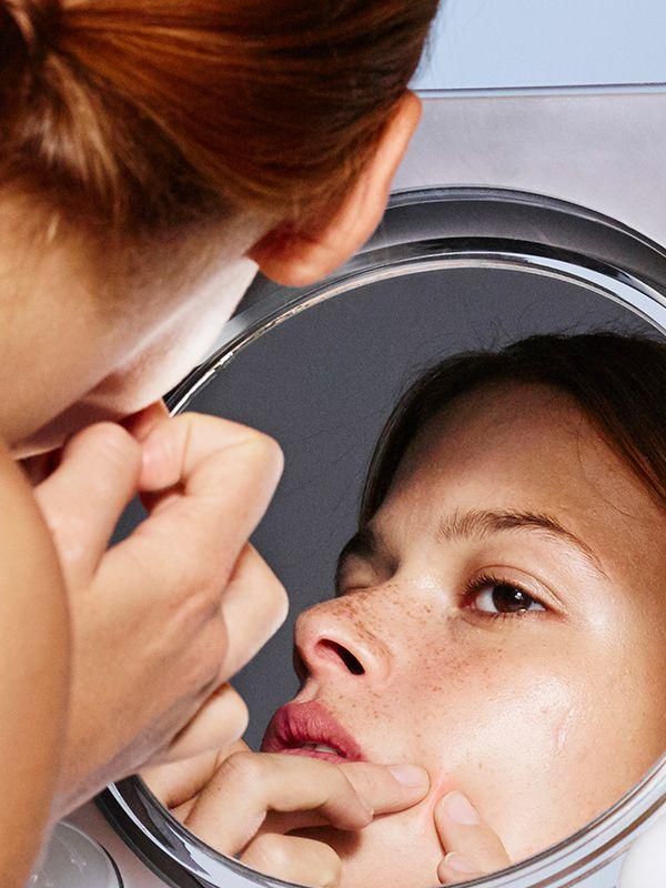 Acne scars : Apakah Bisa Hilang?