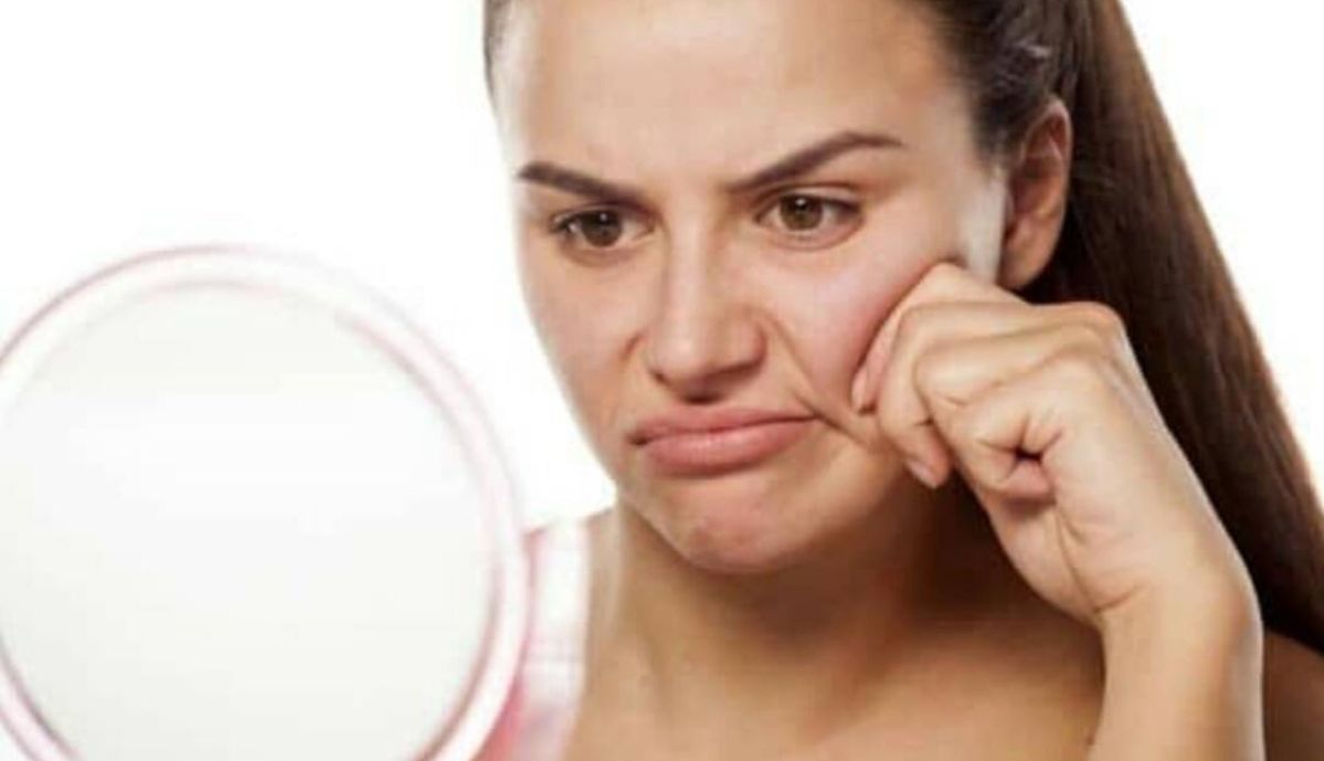 Penyebab Kulit Kusam & Cara Mengatasinya