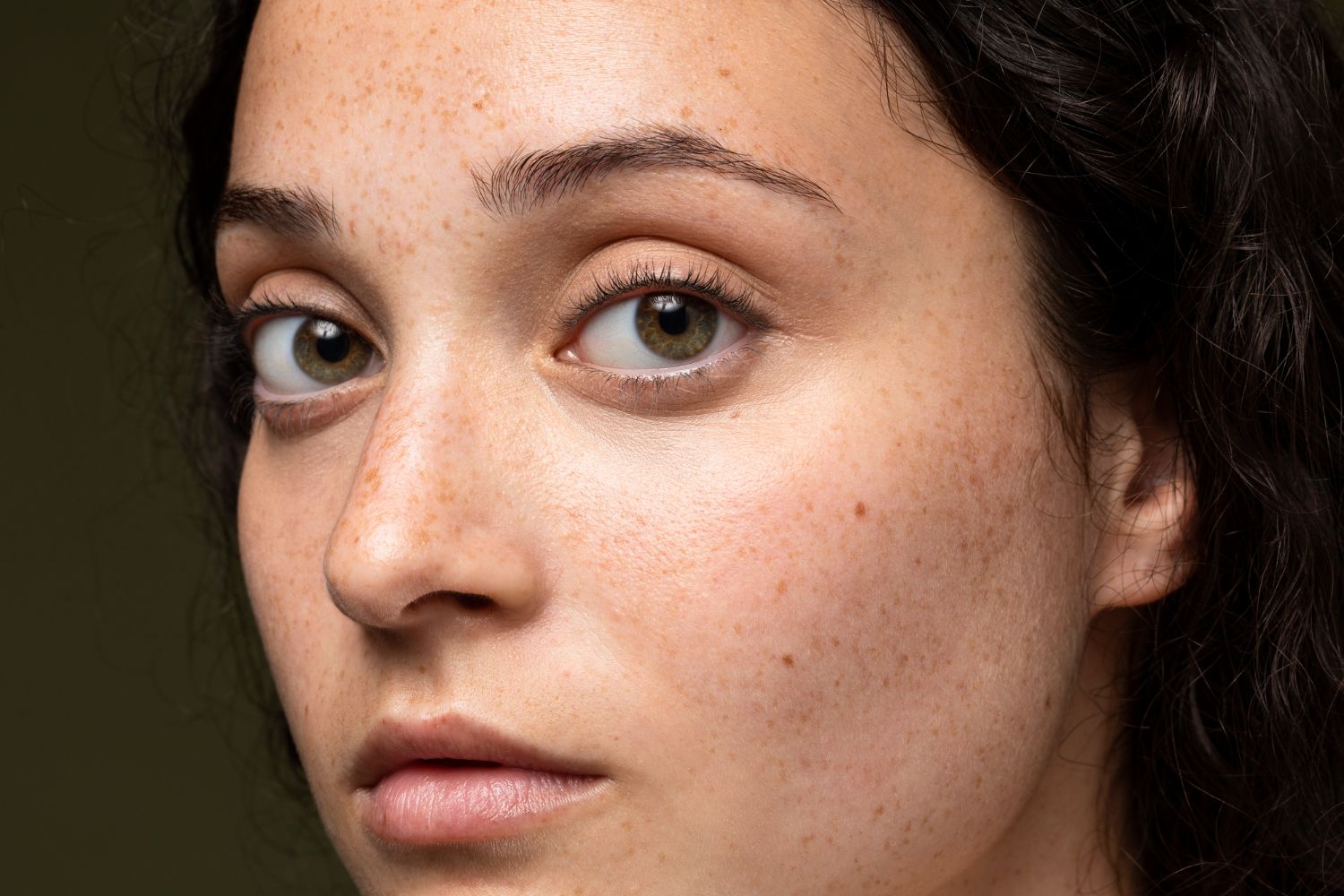 Warna Kulit Ga Rata & Kusam? Coba Kombinasi Hydra Facial + Pico Brightening Ini!